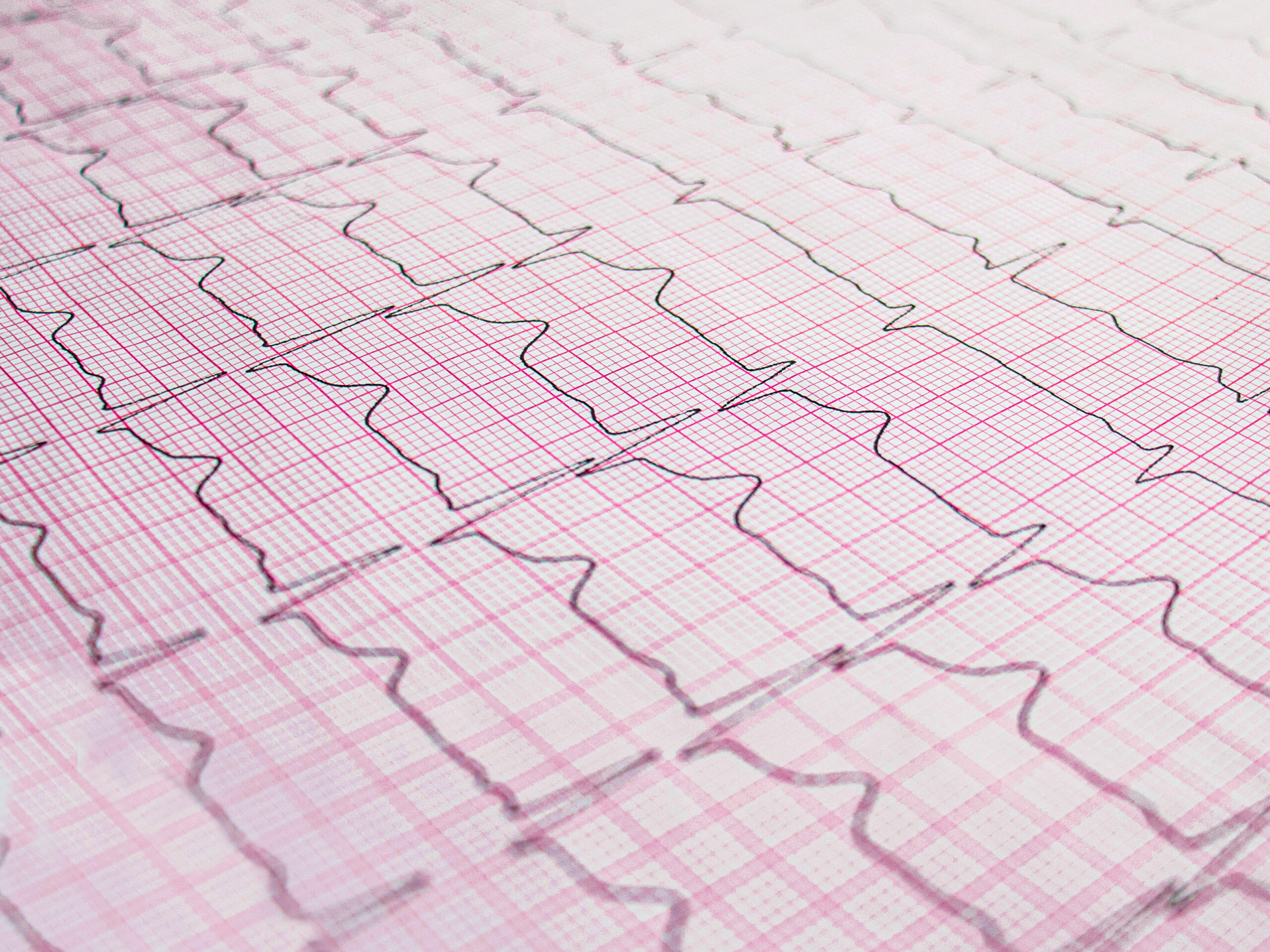 Cardiovascular Telemetry Study In Beagle Dogs | Vivotecnia Cardiovascular telemetry study in beagle dogs: Today in our blog we will talk about the standard cardiovascular telemetry study in beagle dogs.