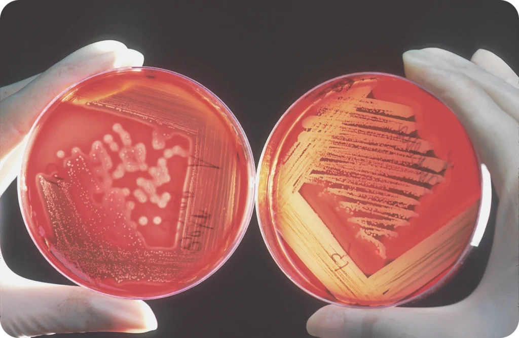 Bacterial Reverse Mutation Test (Ames Test)